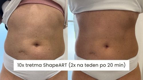 po desetih tretmajih