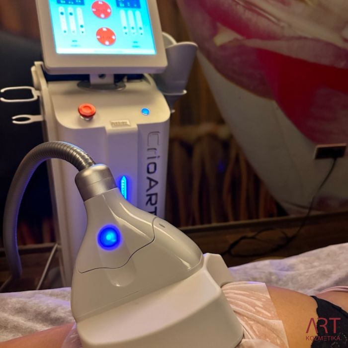 Kriolipoliza CrioART 360