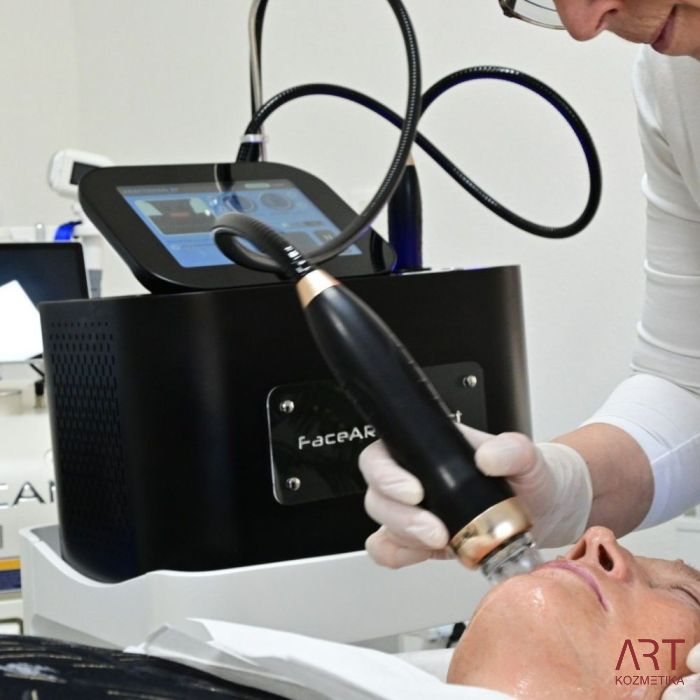 FaceART perfect - napredna tehnologija za nego obraza - microneedling +RF + vacuum