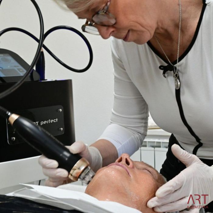 FaceART perfect - napredna tehnologija za nego obraza - microneedling +RF + vacuum