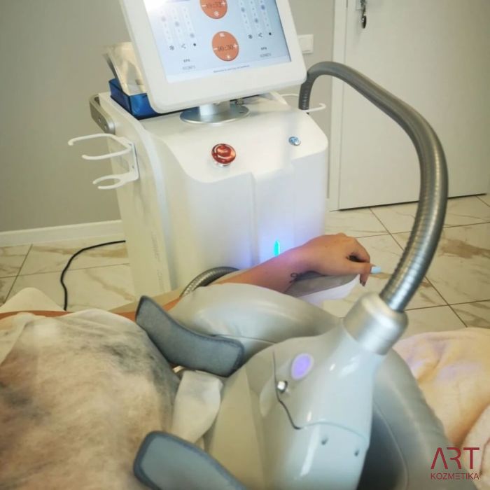 Kriolipoliza CrioART 360