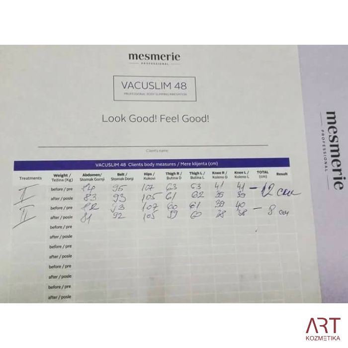 Vacuslim 48 tretma -  INDIVIDUALNO IZOBRAŽEVANJE