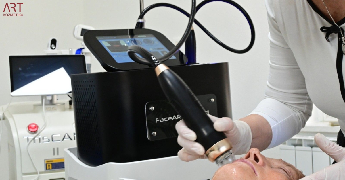 Iglična mezoterapija z radiofrekvenco: Revolucionarna metoda za pomlajevanje kože