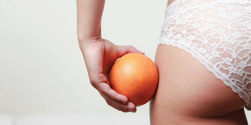 ShapeART anticelulitni tretma ShapeART anticelulitni tretma