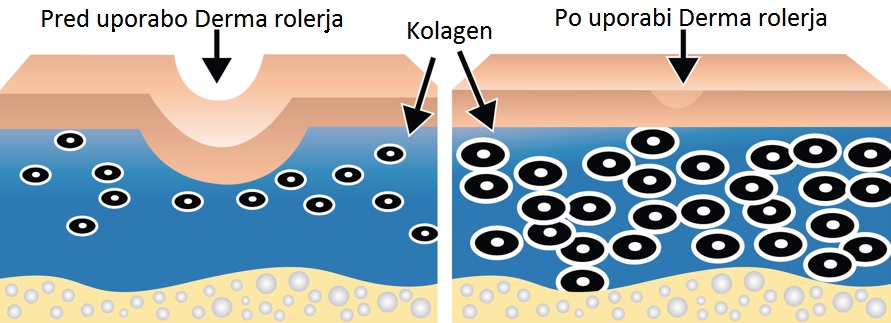 Derma roler