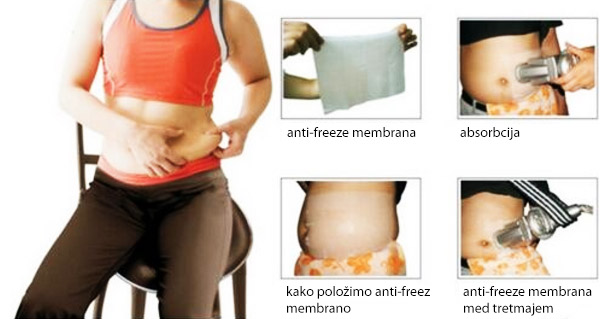 anti-freeze membrana anti-freeze membrana