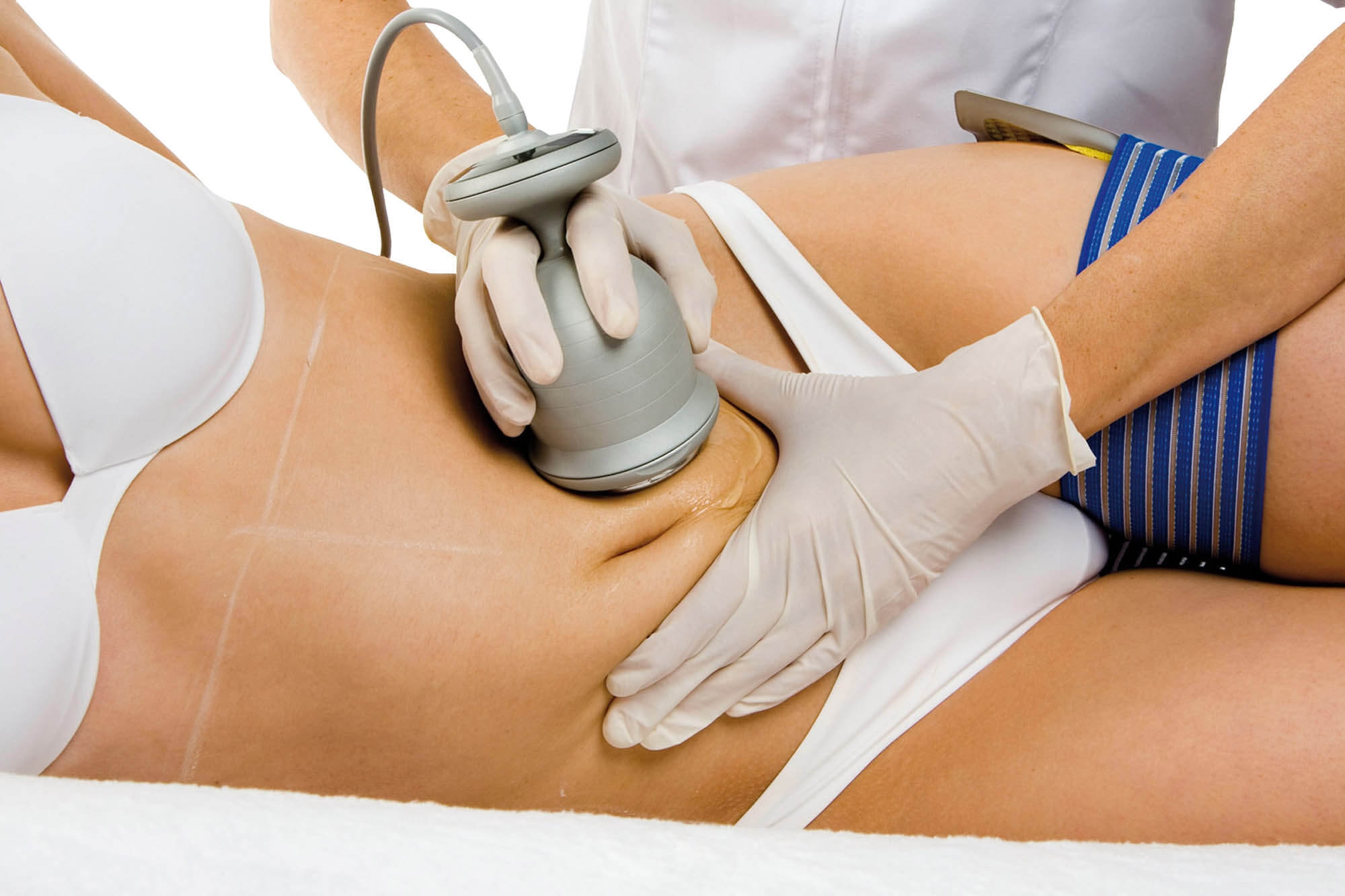 Vakuumska kavitacija Vakuumska kavitacija